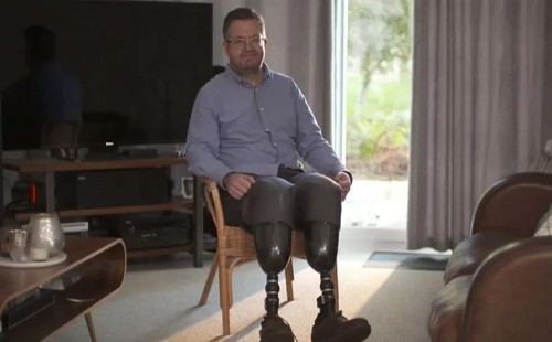 চিকিৎসক নিজেই কেটে ফেললেন পা, দাবি পাঁচ লাখ পাউন্ড বীমা!